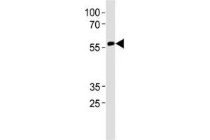 RUNX2 antibody western blot analysis in CEM lysate.