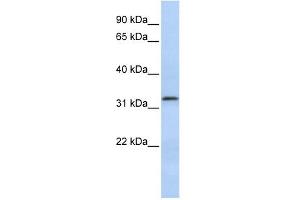 Beta Lactamase 2 antibody used at 1 ug/ml to detect target protein. (LACTB2 anticorps  (Middle Region))