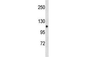 Integrin alpha 7 antibody western blot analysis in CEM lysate.