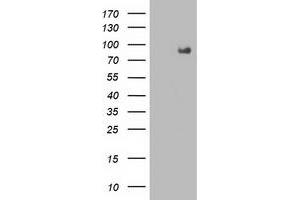 Western Blotting (WB) image for anti-Fibroblast Growth Factor Receptor 2 (FGFR2) antibody (ABIN1498249) (FGFR2 anticorps)