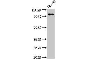 Western Blot Positive WB detected in: HL60 whole cell lysate All lanes: KMT5B antibody at 3 μg/mL Secondary Goat polyclonal to rabbit IgG at 1/50000 dilution Predicted band size: 100, 45, 32 kDa Observed band size: 100 kDa (SUV420H1 anticorps  (AA 100-150))