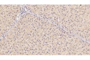 Detection of SHBG in Human Liver Tissue using Monoclonal Antibody to Sex Hormone Binding Globulin (SHBG)