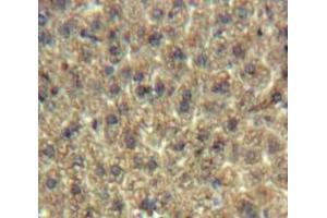 anti-Chromosome 19 Open Reading Frame 80 (C19ORF80) (AA 16-198) antibody