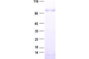 Validation with Western Blot