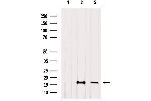 Western blot analysis of extracts from various samples, Acetyl-Histone H4 (Lys12) Antibody.