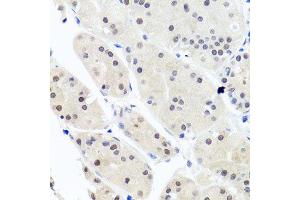 Immunohistochemistry of paraffin-embedded human stomach using HNRNPCL1 antibody (ABIN5995850) at dilution of 1/100 (40x lens).