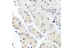 Immunohistochemistry of paraffin-embedded human stomach using HNRNPCL1 antibody (ABIN5995850) at dilution of 1/100 (40x lens). (HNRNPCL1 anticorps)