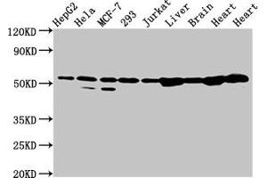 Western Blot Positive WB detected in: HepG2 whole cell lysate, Hela whole cell lysate, MCF-7 whole cell lysate, 293 whole cell lysate, Jurkat whole cell lysate, Rat liver tissue, Rat brain tissue, Rat heart tissue, Mouse heart tissue All lanes: DLD antibody at 2 μg/mL Secondary Goat polyclonal to rabbit IgG at 1/50000 dilution Predicted band size: 55, 44, 50 kDa Observed band size: 55 kDa (DLD anticorps  (AA 398-495))