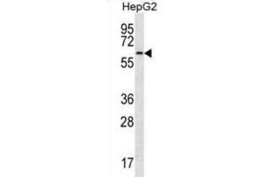Western Blotting (WB) image for anti-CDC14 Cell Division Cycle 14 Homolog A (CDC14A) antibody (ABIN3003762)