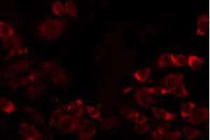 ABIN6274738 staining MCF7 by IF/ICC. (MRPL32 anticorps  (Internal Region))