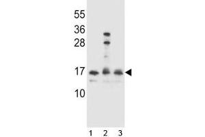HOPX antibody western blot analysis in 1) Ramos, 2) A2058 and 3) 293 lysate.