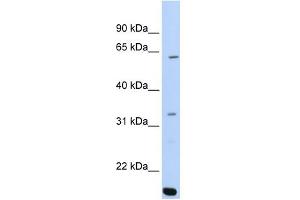 ARID5A anticorps  (C-Term)