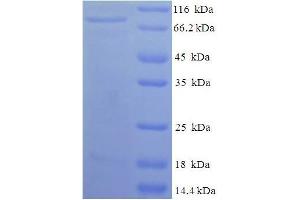 SDS-PAGE (SDS) image for Collapsin Response Mediator Protein 1 (CRMP1) (AA 1-572), (full length) protein (His-SUMO Tag) (ABIN5711331)