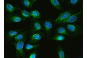 IF analysis of ARL13B using anti-ARL13B antibody (ABIN7600179).