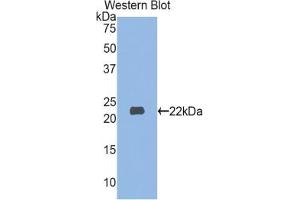 Detection of Recombinant MYL3, Human using Polyclonal Antibody to Myosin Light Chain 3, Alkali, Ventricular, Slow Skeletal (MYL3) (MYL3/CMLC1 anticorps  (AA 5-181))