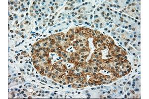 Immunohistochemical staining of paraffin-embedded Kidney tissue using anti-TYRO3mouse monoclonal antibody. (TYRO3 anticorps)