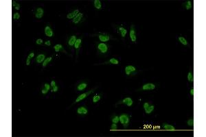 Immunofluorescence of monoclonal antibody to TRIM24 on HeLa cell. (TRIM24 anticorps  (AA 432-569))