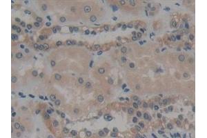 Detection of MYH10 in Human Kidney Tissue using Polyclonal Antibody to Myosin Heavy Chain 10, Non Muscle (MYH10)