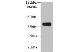 Western blot All lanes: ASB7 antibody at 8 μg/mL + A431 whole cell lysate Secondary Goat polyclonal to rabbit IgG at 1/10000 dilution Predicted band size: 37, 31 kDa Observed band size: 37 kDa (ASB7 anticorps  (AA 1-274))