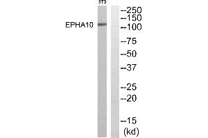 Western blot analysis of extracts from NIH-3T3 cells, using EPHA10 antibody. (EPH Receptor A10 anticorps  (Internal Region))