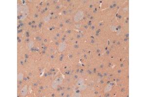 Used in DAB staining on fromalin fixed paraffin- embedded brain tissue (ATP2B2 anticorps  (AA 417-830))