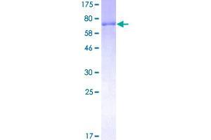 Image no. 1 for Thyroid Hormone Receptor Interactor 6 (TRIP6) (AA 1-476) protein (GST tag) (ABIN1323782)