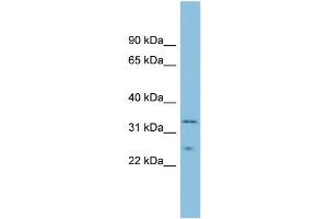 WB Suggested Anti-MSRA Antibody Titration: 0. (MSRA anticorps  (Middle Region))