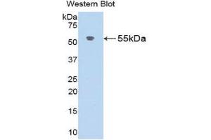 Western Blotting (WB) image for anti-Angiotensinogen (serpin Peptidase Inhibitor, Clade A, Member 8) (AGT) (AA 25-477) antibody (ABIN3207838) (AGT anticorps  (AA 25-477))