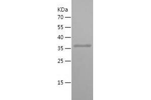 Western Blotting (WB) image for Rab9 Effector Protein with Kelch Motifs (RABEPK) (AA 120-367) protein (His tag) (ABIN7124765)