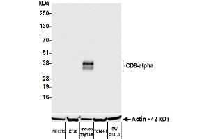 Western Blotting (WB) image for anti-CD8a Molecule (CD8A) (AA 28-194) antibody (ABIN7453877) (Recombinant CD8 alpha anticorps  (AA 28-194))