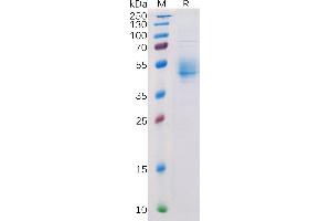 Human PVRIG Protein, hFc Tag on SDS-PAGE under reducing condition.