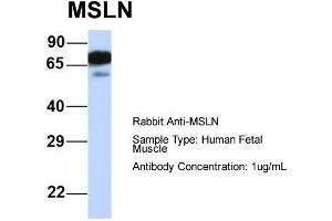 Host:  Rabbit  Target Name:  MSLN  Sample Type:  Human Fetal Muscle  Antibody Dilution:  1. (Mesothelin anticorps  (Middle Region))