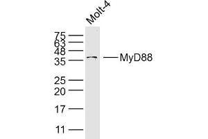 Molt-4 lysates probed with MyD88 Polyclonal Antibody, Unconjugated  at 1:300 dilution and 4˚C overnight incubation.