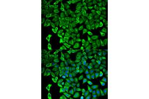 Immunofluorescence analysis of HeLa cells using PSMD2 antibody. (PSMD2 anticorps)