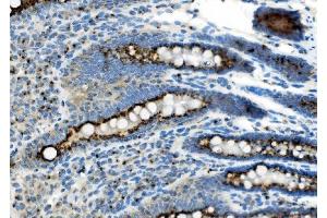 IHC analysis of Golm1/GOLPH2 using anti-Golm1/GOLPH2 antibody (ABIN7601504).