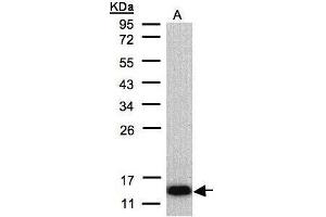 WB Image Sample(30 μg of whole cell lysate) A:Raji, 12% SDS PAGE antibody diluted at 1:500 (COX6A2 anticorps  (C-Term))