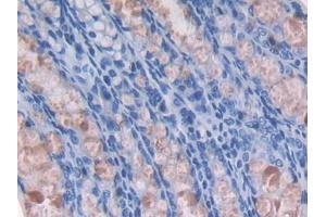 DAB staining on IHC-P; Samples: Mouse Colon Tissue