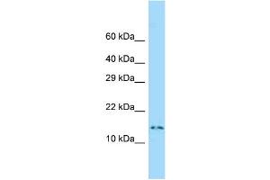 WB Suggested Anti-Dnalc4 Antibody Titration: 1. (DNAL4 anticorps  (Middle Region))