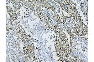 IHC analysis of Filamin B/FLNB using anti-Filamin B/FLNB antibody (ABIN7601607).