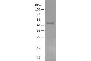 Western Blotting (WB) image for Forkhead Box O3 (FOXO3) (AA 478-673) protein (His-IF2DI Tag) (ABIN7122994)