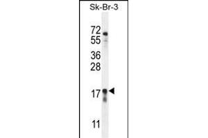 C Antibody (Center) (ABIN655473 and ABIN2844997) western blot analysis in SK-BR-3 cell line lysates (35 μg/lane). (C1ORF115 anticorps  (AA 76-104))