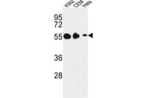 Western Blotting (WB) image for anti-Galanin Receptor 1 (GALR1) antibody (ABIN3004139) (Galanin Receptor 1 anticorps)