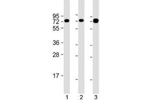 Western blot testing of human 1) Jurkat, 2) Ramos and 3) HT-1080 cell lysate with GARS antibody at 1:2000.
