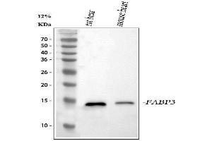 Western blot analysis of Cardiac FABP/Fabp3 using anti-Cardiac FABP/Fabp3 antibody (ABIN5518983).