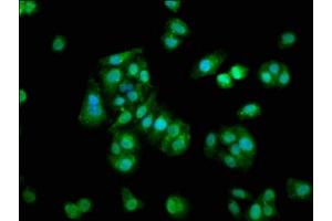 Immunofluorescence staining of HepG2 cells with ABIN7166030 at 1:133, counter-stained with DAPI. (S100A1 anticorps  (AA 2-94))