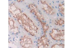 Used in DAB staining on fromalin fixed paraffin- embedded kidney tissue