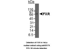 Image no. 1 for anti-Nuclear Receptor Subfamily 1, Group H, Member 4 (NR1H4) (C-Term) antibody (ABIN363483) (NR1H4 anticorps  (C-Term))