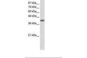 Image no. 2 for anti-Aprataxin (APTX) (C-Term) antibody (ABIN203063) (Aprataxin anticorps  (C-Term))