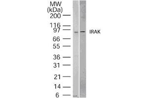 Image no. 1 for anti-Interleukin-1 Receptor-Associated Kinase 1 (IRAK1) (AA 700-712) antibody (ABIN208558) (IRAK1 anticorps  (AA 700-712))