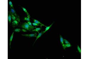 Immunofluorescence staining of Hela cells with ABIN7157178 at 1:100, counter-stained with DAPI.